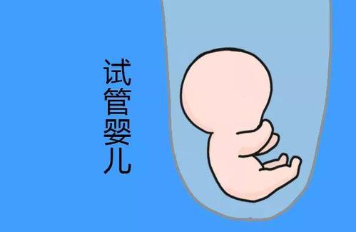 时差成像